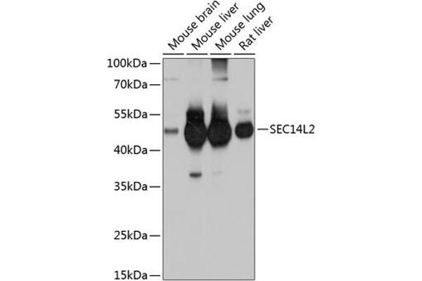 SEC14L2 anticorps  (AA 60-270)