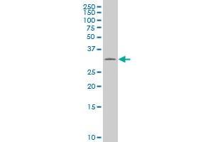 anti-Solute Carrier Family 22 (Organic Cation Transporter), Member 18 Antisense (SLC22A18AS) (AA 144-253) antibody