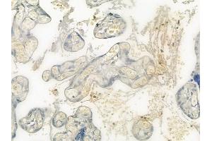 ABIN6265334 and ABIN6276392 at 1/100 staining human normal placenta tissue by IHC-P. (STEAP3 antibody  (N-Term))