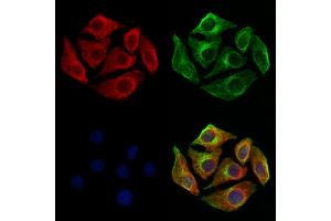 ABIN6260842 and ABIN6273209 staining Hela cells by IF/ICC.