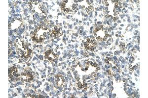 Rabbit Anti-SUV39H1 antibody   Paraffin Embedded Tissue: Human Lung cell Cellular Data: alveolar cell of renal tubule Antibody Concentration: 4. (SUV39H1 antibody  (N-Term))