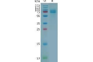Activated Leukocyte Cell Adhesion Molecule (ALCAM) (AA 28-526) protein (His tag)