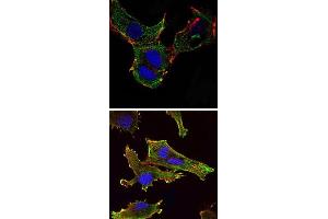 Immunofluorescence analysis of NTERA-2 cells (upper) and U251 (bottom) cells using KLHL13 monoclonal antibody, clone 8D1  (green) .