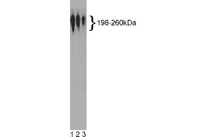 Western Blotting (WB) image for anti-Nestin (NES) antibody (ABIN967492) (Nestin antibody)