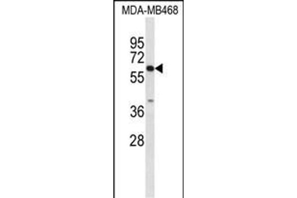 CES5A Antikörper  (AA 244-270)