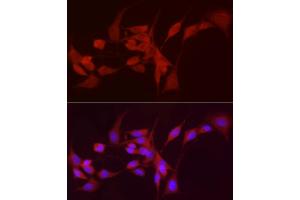 Immunofluorescence (IF) image for anti-Alcohol Dehydrogenase 5 (Class III), chi Polypeptide (ADH5) (AA 1-374) antibody (ABIN6136579)