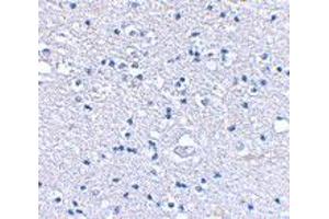 Immunohistochemical staining of human brain tissue using GRIK4 polyclonal antibody  at 2. (GRIK4 antibody  (N-Term))