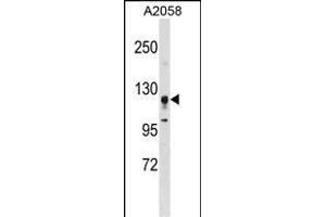 STK31 Antibody (F47) (ABIN391358 and ABIN2841378) western blot analysis in  cell line lysates (35 μg/lane). (STK31 antibody  (N-Term))