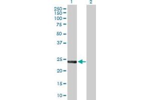 Western Blot analysis of SNAP23 expression in transfected 293T cell line by SNAP23 MaxPab polyclonal antibody. (SNAP23 antibody  (AA 1-211))