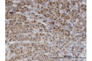 Immunoperoxidase of monoclonal antibody to PIK3C2A on formalin-fixed paraffin-embedded human adrenal gland.