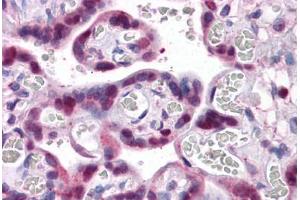 Human Placenta: Formalin-Fixed, Paraffin-Embedded (FFPE) (SMAD6 antibody  (AA 285-385))