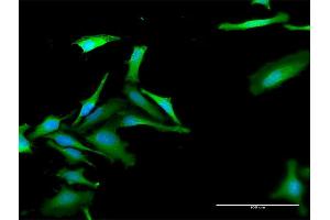 Immunofluorescence of purified MaxPab antibody to FBXO42 on HeLa cell. (FBXO42 antibody  (AA 1-716))