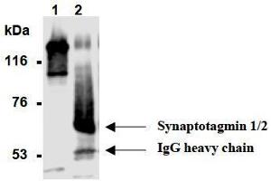Western Blotting (WB) image for anti-Synaptotagmin I (SYT1) antibody (ABIN1109184) (SYT1 antibody)