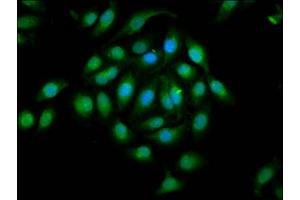 Immunofluorescence staining of A549 cells with ABIN7151835 at 1:133, counter-stained with DAPI.