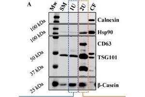 (A) Western Blot analysis of proteins present (Hsp90, CD63 and TSG101) or absent (calnexin) in exosomes and abundant in bovine milk (β-casein). (CD63 antibody  (AA 101-200))