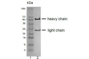 SDS-PAGE (SDS) image for anti-CD81 (CD81) antibody (ABIN1720914)