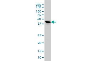 TSSK2 monoclonal antibody (M02), clone 1H2 Western Blot analysis of TSSK2 expression in HeLa .