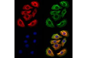ABIN6262304 and ABIN6272944 staining Hela cells by IF/ICC.