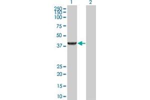 Western Blot analysis of PIPOX expression in transfected 293T cell line by PIPOX MaxPab polyclonal antibody. (PIPOX antibody  (AA 1-390))