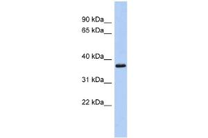 WB Suggested Anti-MBP Antibody Titration: 0. (MBP antibody  (Middle Region))