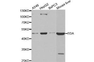 Western blot analysis of extracts of various cell lines, using EDA antibody. (Ectodysplasin A antibody)