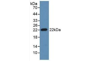 Detection of Recombinant ADM, Mouse using Polyclonal Antibody to Adrenomedullin (ADM) (Adrenomedullin antibody  (AA 24-171))