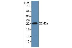 Detection of Recombinant ADM, Mouse using Polyclonal Antibody to Adrenomedullin (ADM) (Adrenomedullin antibody  (AA 24-171))