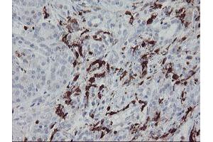 Image no. 10 for anti-Coagulation Factor XIII, A1 Polypeptide (F13A1) antibody (ABIN1498150) (F13A1 antibody)