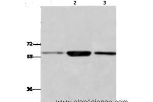 Western Blot analysis of K562,231,Human fetal liver tissue using GPC6 Polyclonal Antibody at dilution of 1:700 (Glypican 6 antibody)