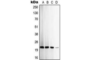 Western blot analysis of TIMP2 expression in HeLa (A), SW480 (B), MCF7 (C), K562 (D) whole cell lysates. (TIMP2 antibody  (Center))