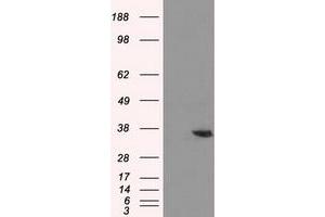 HEK293T cells were transfected with the pCMV6-ENTRY control (Left lane) or pCMV6-ENTRY AKR1A1 (Right lane) cDNA for 48 hrs and lysed. (AKR1A1 antibody)