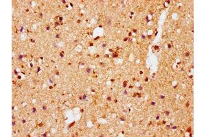IHC image of ABIN7127752 diluted at 1:100 and staining in paraffin-embedded human brain tissue performed on a Leica BondTM system. (Recombinant SNCA antibody  (pSer129))