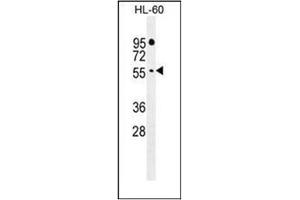 Western blot analysis of FBXW11 Antibody (Center) in HL-60 cell line lysates (35ug/lane). (FBXW11 antibody  (Middle Region))