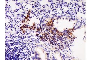 Paraformaldehyde-fixed, paraffin embedded rat lung, Antigen retrieval by boiling in sodium citrate buffer (pH6) for 15min, Block endogenous peroxidase by 3% hydrogen peroxide for 30 minutes, Blocking buffer (normal goat serum) at 37°C for 20min, Antibody incubation with	Rabbit Anti-ABCD1/CCL22 Polyclonal Antibody, Unconjugated  at 1:500 overnight at 4°C, followed by a conjugated secondary for 90 minutes and DAB staining. (CCL22 antibody  (AA 51-93))
