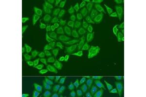 Immunofluorescence analysis of U2OS cells using EXOC2 Polyclonal Antibody at dilution of 1:100. (EXOC2 antibody)