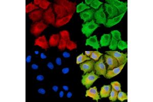 ABIN7094981 and ABIN7099037 staining  cells by IF/ICC.