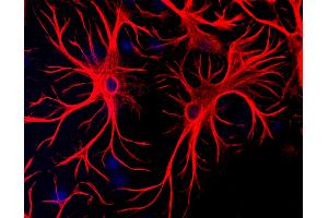 Mixed cultures of neurons and glia stained with chicken anti-GFAP (red), and DNA (blue). (GFAP antibody)
