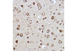Immunohistochemistry of paraffin-embedded rat brain using CARS Rabbit mAb (ABIN7266624) at dilution of 1:100 (40x lens). (CARS antibody)