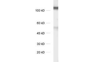 dilution 1 : 1000, sample: synaptic membrane fraction of rat brain (LP1) (DLG3 antibody)