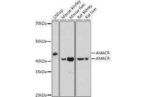 Western blot analysis of extracts of various cell lines, using AMACR antibody (ABIN3021497, ABIN3021498, ABIN3021499 and ABIN6215153) at 1:1000 dilution. (AMACR antibody  (AA 1-198))