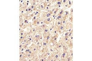 Immunohistochemistry (Paraffin-embedded Sections) (IHC (p)) image for anti-Solute Carrier Family 16, Member 11 (Monocarboxylic Acid Transporter 11) (SLC16A11) (AA 48-76), (N-Term) antibody (ABIN654868)