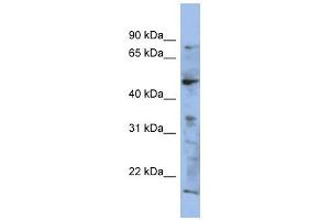 RAB3IP antibody used at 1 ug/ml to detect target protein. (RAB3IP antibody)