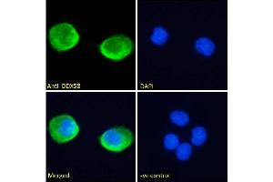 ABIN6391376 Immunofluorescence analysis of paraformaldehyde fixed A431 cells, permeabilized with 0. (DDX58 antibody  (C-Term))