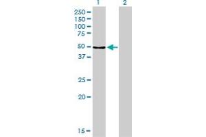 Western Blot analysis of MPP1 expression in transfected 293T cell line by MPP1 monoclonal antibody (M02), clone 1C3-1D11.