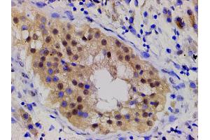 ABIN6267554 at 1/200 staining human seminoma tissue sections by IHC-P.