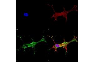 Immunocytochemistry/Immunofluorescence analysis using Mouse Anti-Notch1 Monoclonal Antibody, Clone S253-32 (ABIN2483204). (Notch1 antibody  (AA 20-216) (PE))