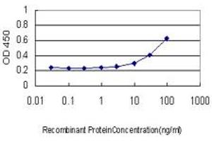 Detection limit for recombinant GST tagged PDK1 is approximately 3ng/ml as a capture antibody.