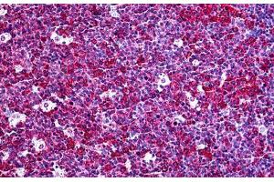 Human Tonsil: Formalin-Fixed, Paraffin-Embedded (FFPE) (CXCL5 antibody  (AA 1-115))