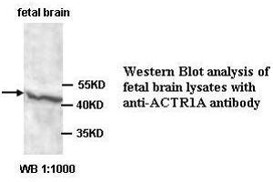 Image no. 1 for anti-Alpha Centractin (ACTR1A) antibody (ABIN1574449)