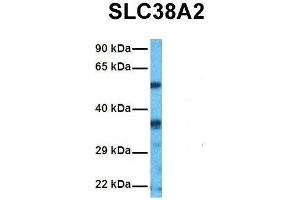Host:  Rabbit  Target Name:  SLC38A2  Sample Tissue:  Human HepG2  Antibody Dilution:  1. (SLC38A2 antibody  (N-Term))